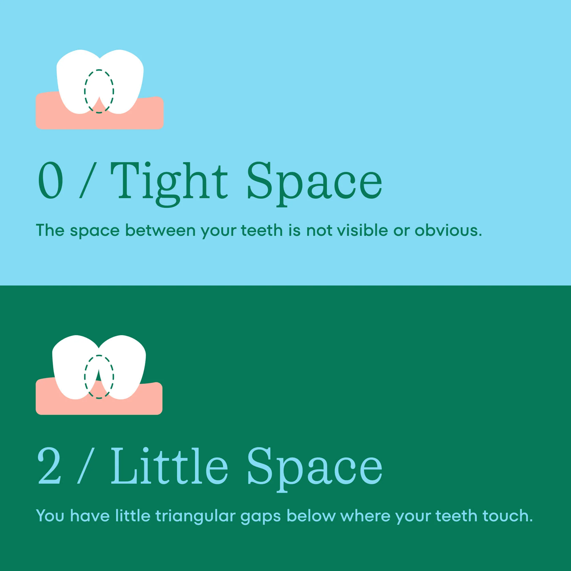 Braces Power Duo - Image 7
